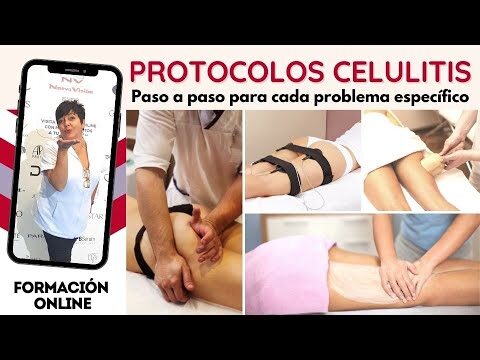 Eliminación de Celulitis: Beneficios de las Sesiones de Sauna